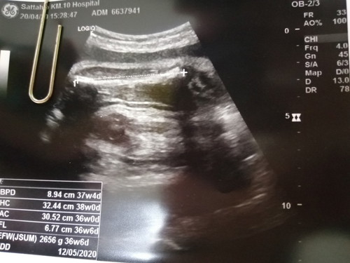 คุณแม่บ้านไหนลุ้นเพศลูกจนถึงตอนคลอดมั้ยคะ