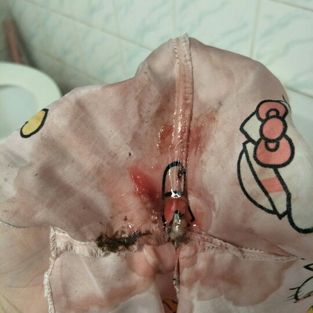 ครรภ์แรกขอสอบถามแม่ๆหน่อยค่ะ