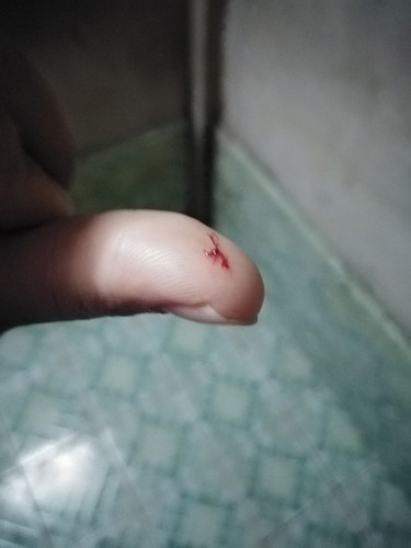 เป็นแบบนี้คืออะไรคะ