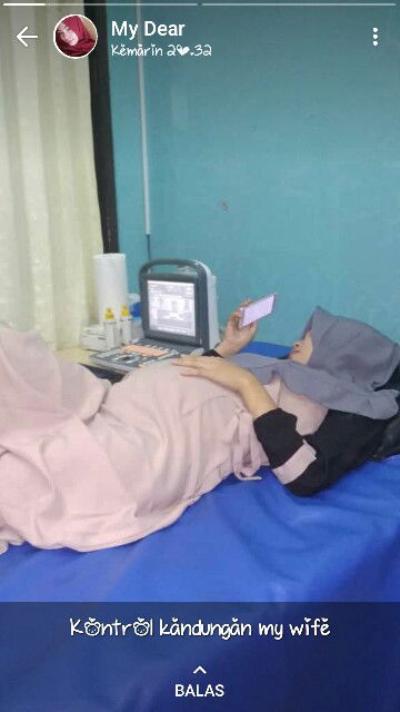 Tiap USG  hasil hpl sma umur janin berbeda