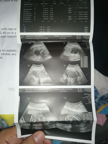 Ultrasound Result