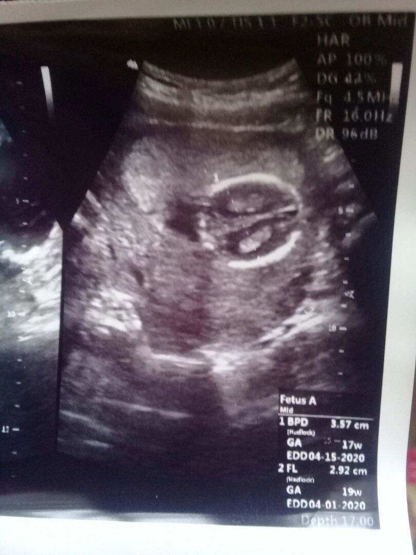 nanya bun gak sempet nanya ke doktr.a