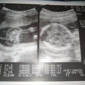 แม่ๆค่ะช่วยดูหน่อยค่ะแบบนี้หญิงหรือชายค่ะ