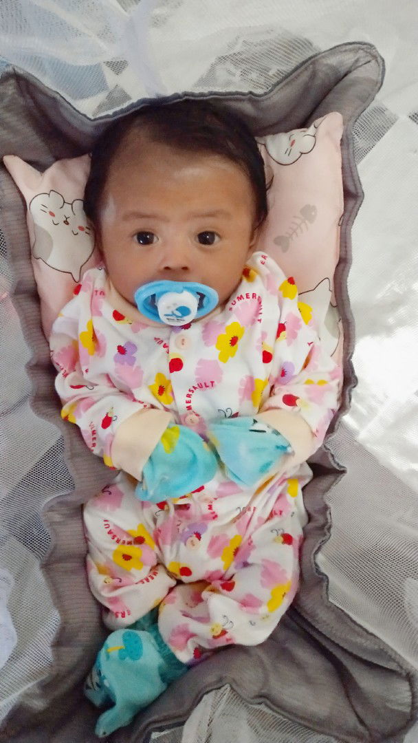 bener gak sih bun, pake popok bisa bikin dede jalannya ngangkang?