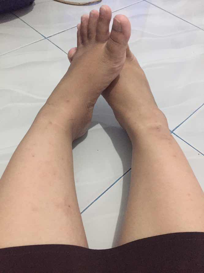Gatel" di kaki dan tangan week 37