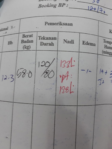 Nadi laju
