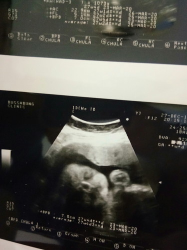 27+6weekอยากเจอหน้าลูกจังค่ะ