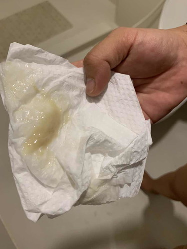 มีมูกขาวออกมาเเต่ยังไม่มีเลือดเเบบนี้คือใกล้คลอดหรือยังครับ