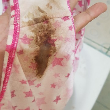 brown spot