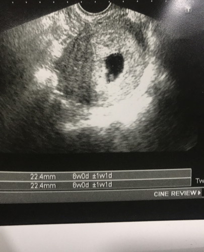 มีเลือดออก นิดหน่อยค่ะ