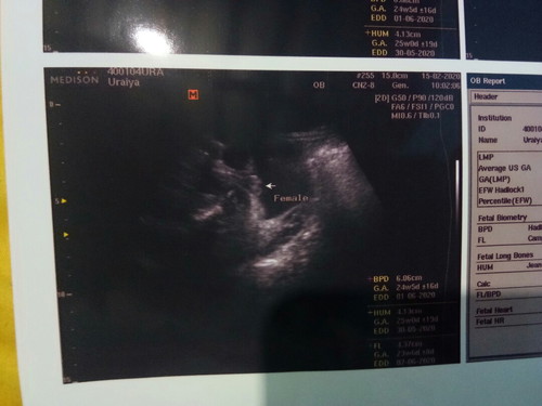 แบบนี้เพศอะไรค่ะแม่