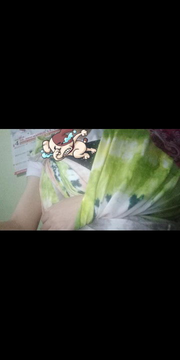 carpal tunnel syndrom