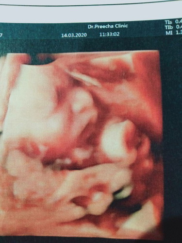 อีก 2 เดือนก็เจอกันแล้ว