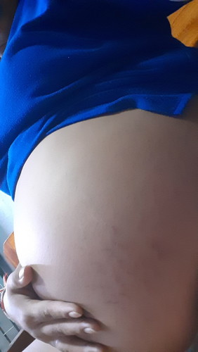 ท้องแรกค่ะปัญจุบัน 36+1 วีค