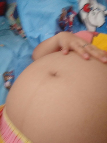 ลูกกลับหัวตอนกีวีค