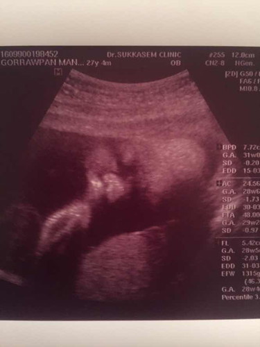 31 w