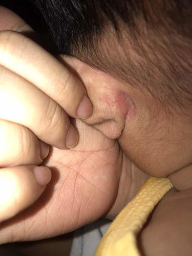 หลังหูลูกมีกลิ่น