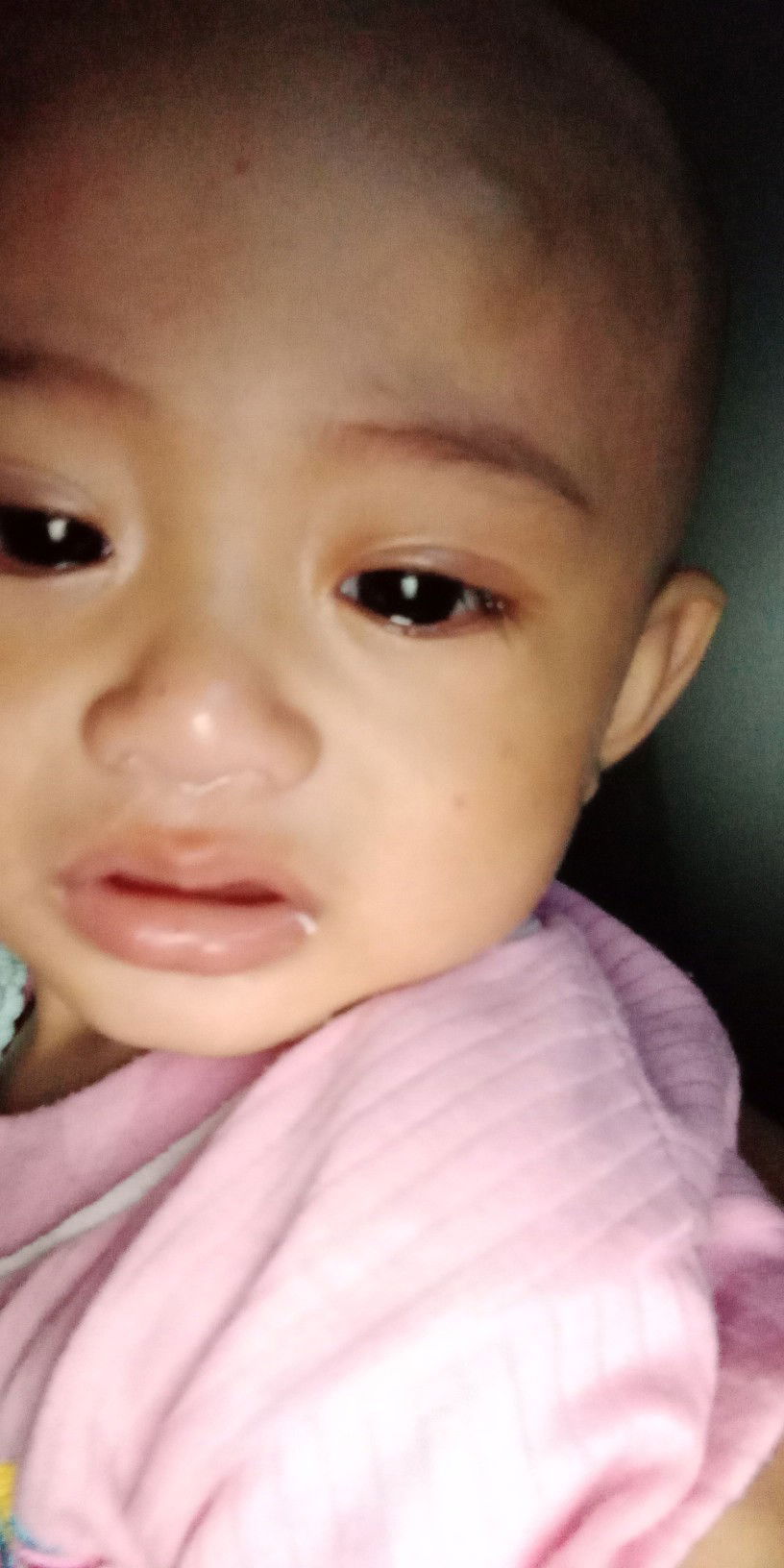 obat sariawan yg aman untuk bayi 9bulan