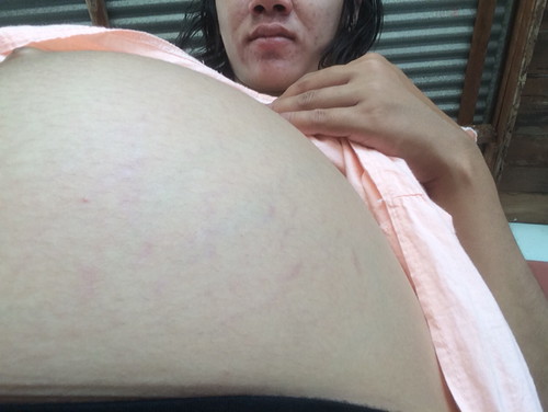 ขอปรึกษาหน่อยคะ