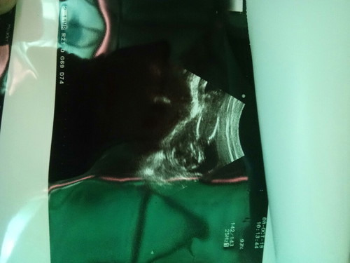 จะ6เดือนเเล้วจ้า