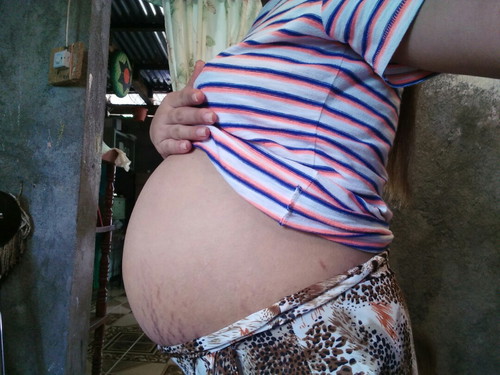 Tummy ?