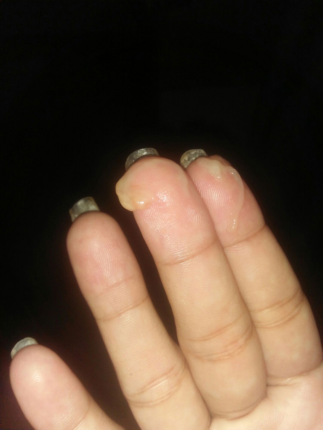 Discharge na ba 'to? 