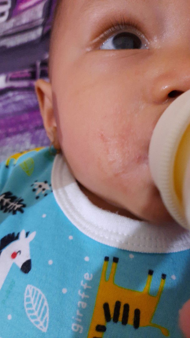 pinggiran mulut merah2