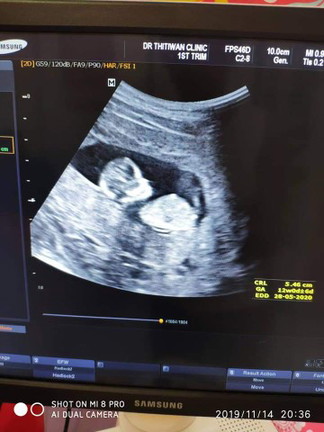 11+3 วีค ชัดมั้ยคะ