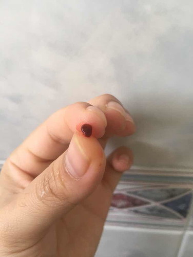 Minta pendapat momies