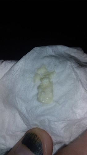 jangan di buka ya ini gmbar keputihan