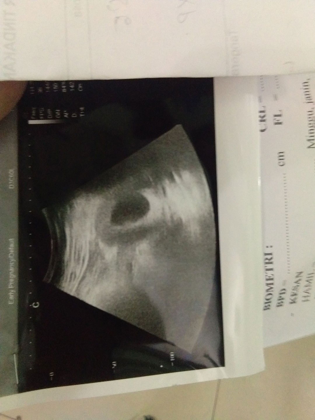 8 week di nyatakn Bo