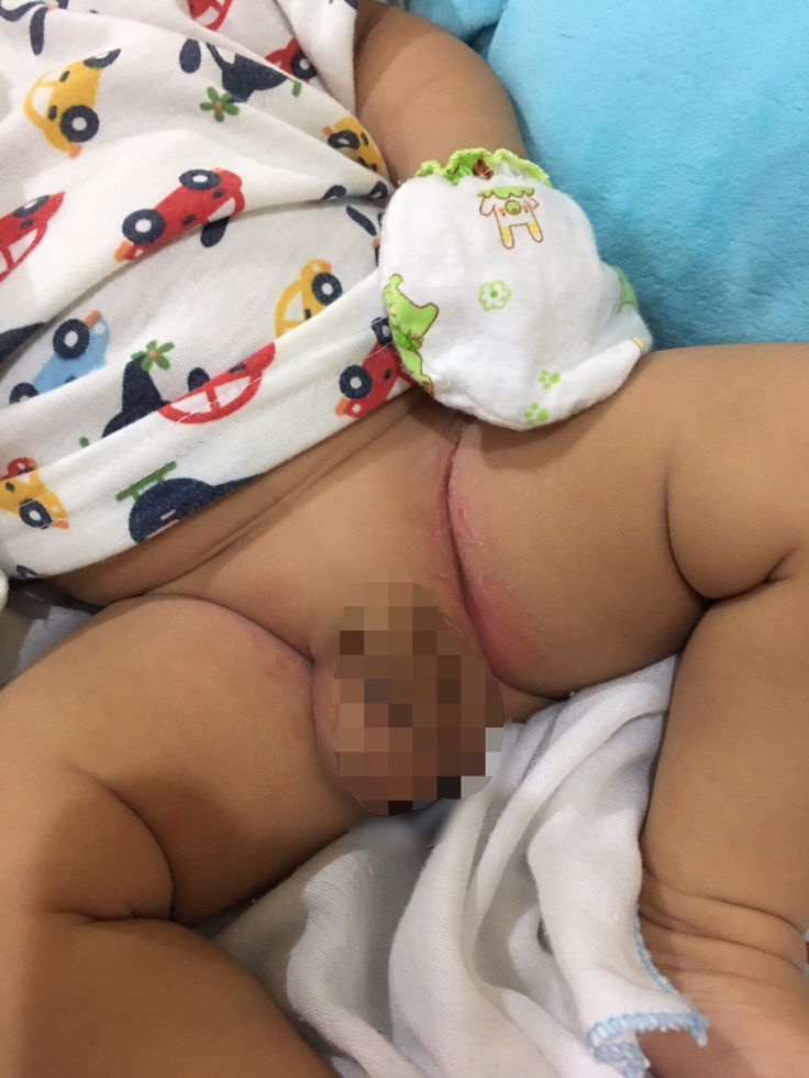 ขอความรู้วิธีรักษาน้องหน่อยค่ะ