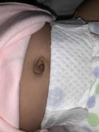 Umbilical cord