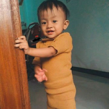 apa iya seperti anak sindrom?