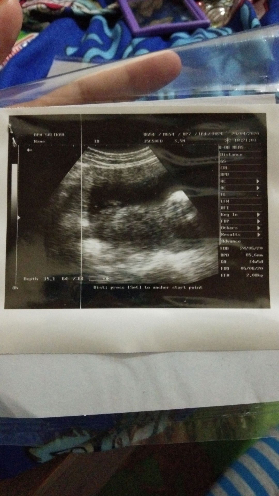 Persiapan Persalinan