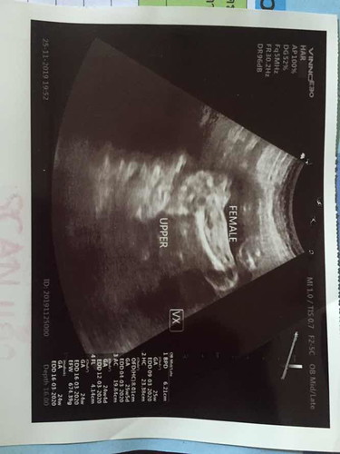 หมอบอกผู้หญิง ชัวร์มั้ยคะว่าผู้หญิง