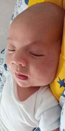 bintik merah satu wajah