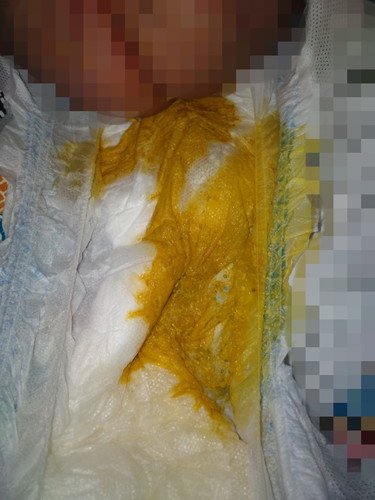 pasensya na po sa picture..