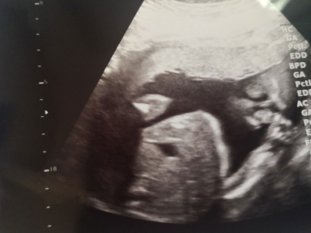 แวะดูหน้าลูกสาว