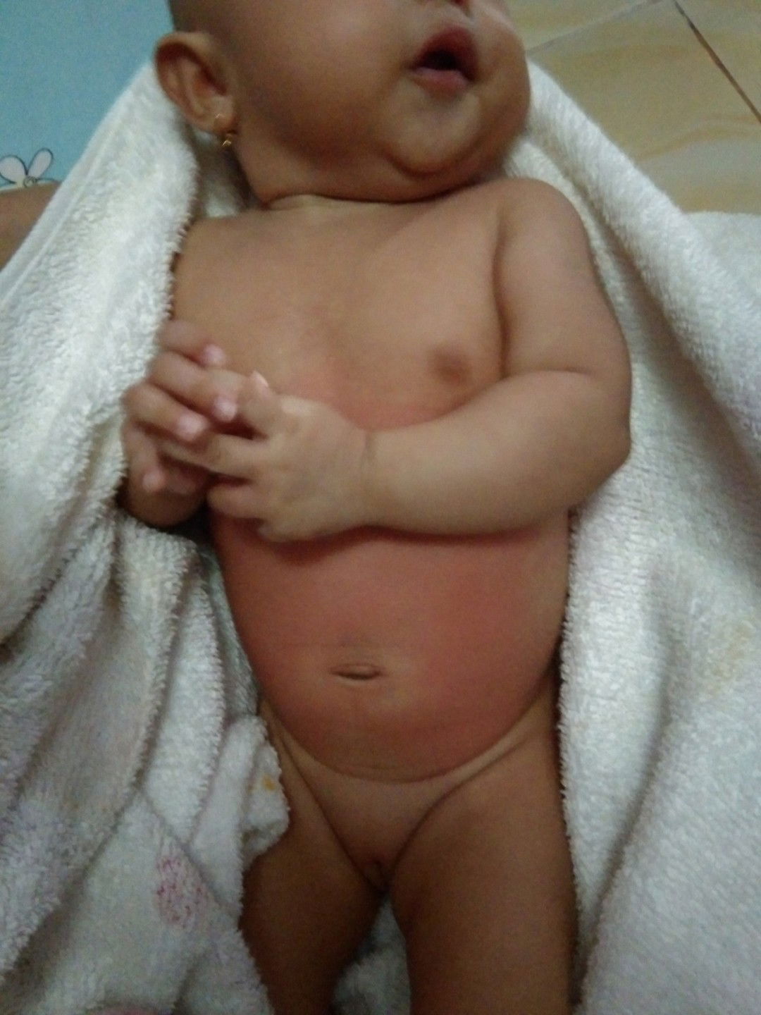 Merah di bdn bayi