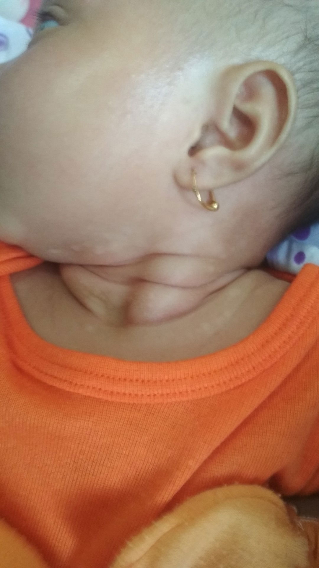 muncul putih2 seperti panu