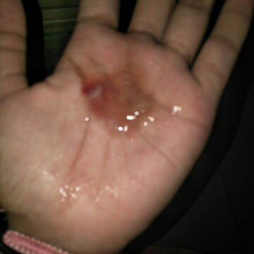 lendirr dari jalur rahim