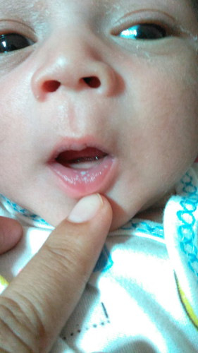 bibir putih2