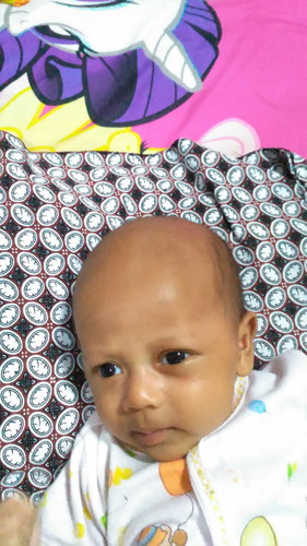 rambut rontok