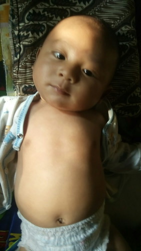 kpla bayi miring kiri