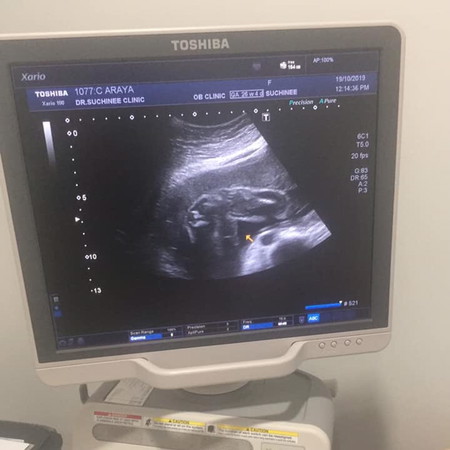 26w 4d ผู้ชายจ้า