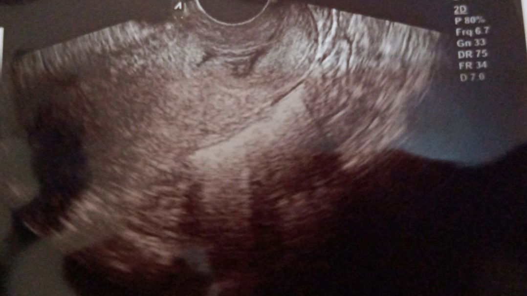 apakah ini keguguran ?