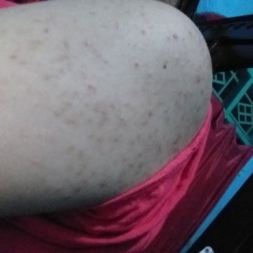 minta solusinya bund