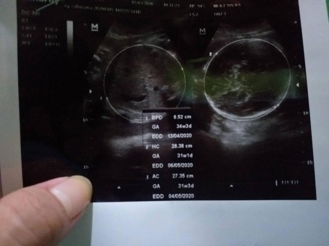 cara cepat naikin BB janin?