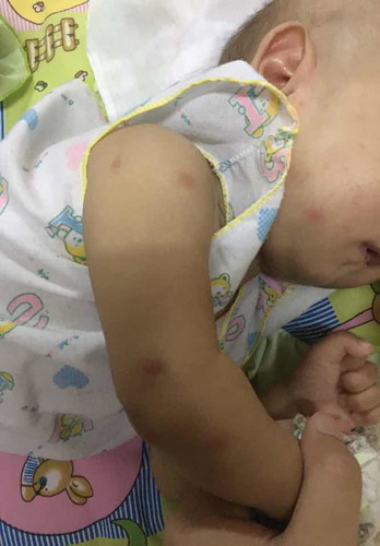 ลูกโดนยุ่งกัด